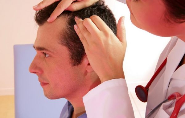 Top Tips on Help Prevent MPH Male Pattern Hair Loss man doctor hair loss | Lifestyle