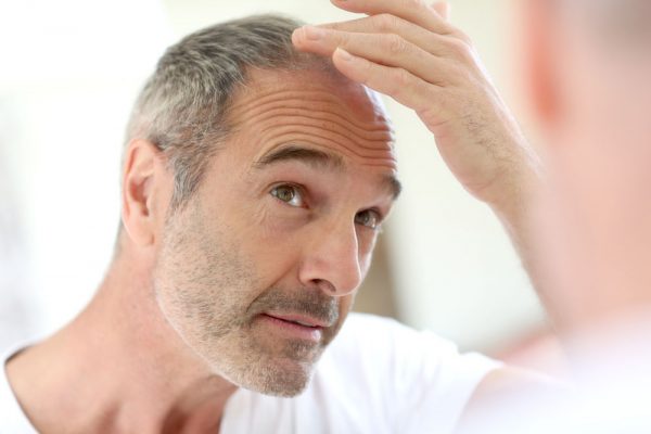 Top Tips on Help Prevent MPH Male Pattern Hair Loss older man with hair loss | Lifestyle